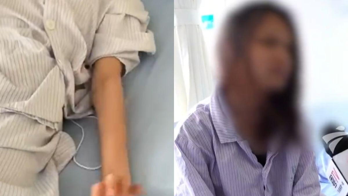 20-yr-old woman diagnosed with rare brain complication after weekly bubble tea habit