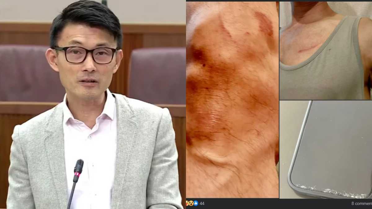 Baey Yam Keng reports minor injuries after collision with cyclist during morning run