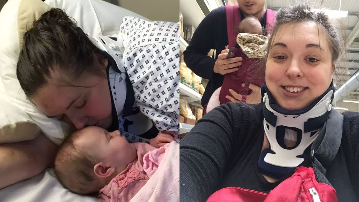 UK woman breaks neck while yawning and survives after life-saving surgery