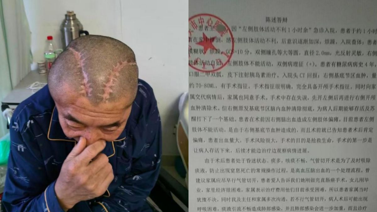 Chinese hospital under investigation after wrong-side brain surgery leaves patient disabled