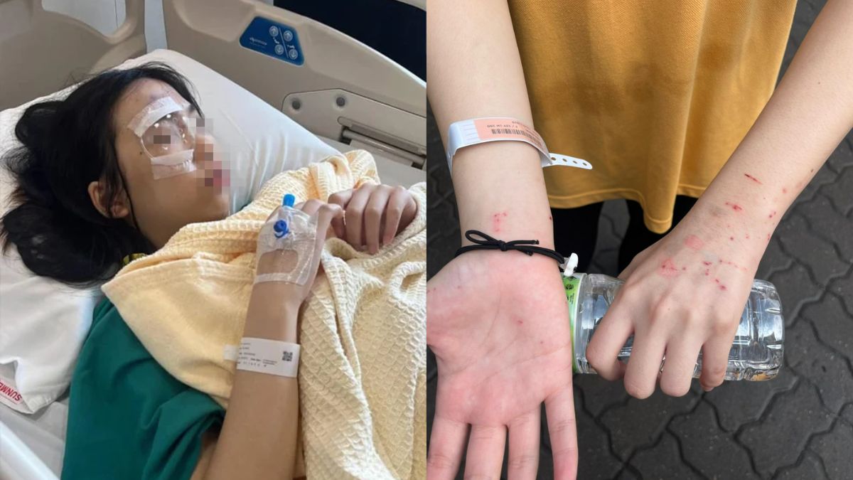 Malaysian mother accuses unregistered international school of negligence after lab explosion injures daughter