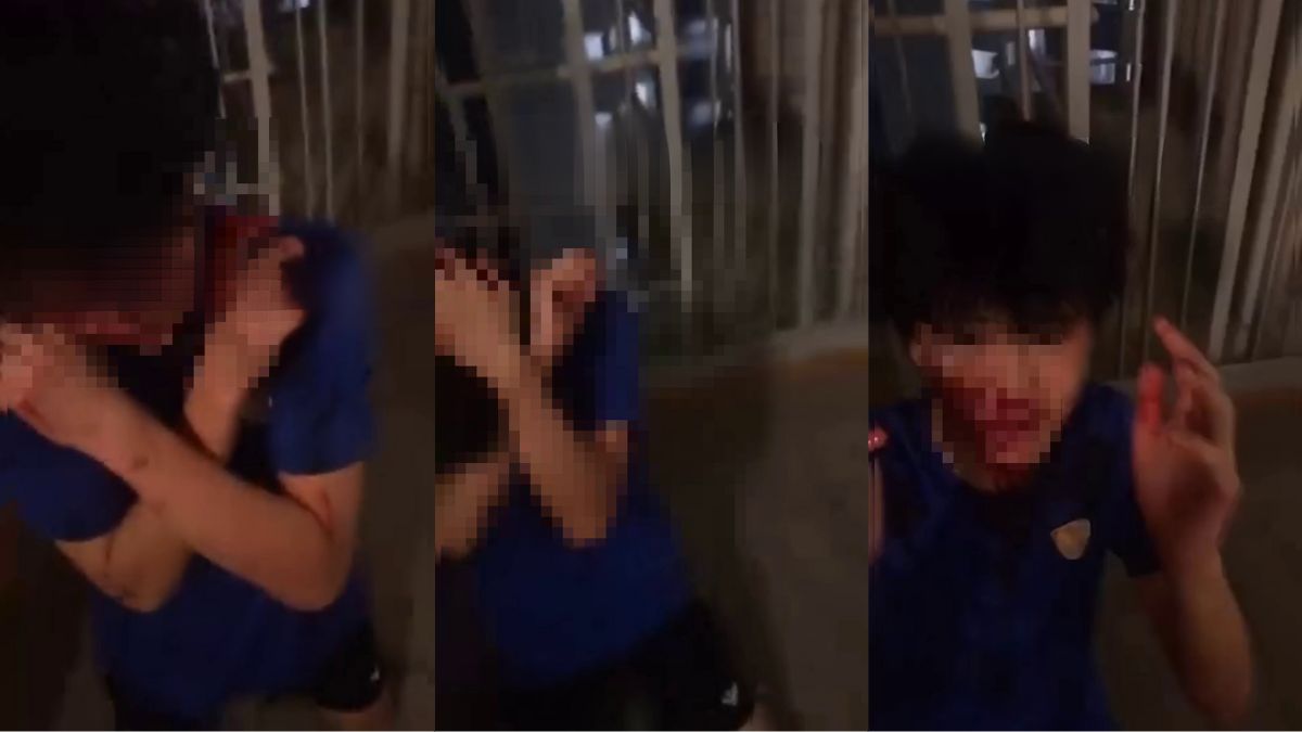 Singapore police investigate video of boy covered in blood, slapped and forced to apologise